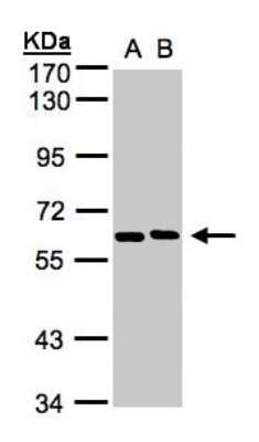 Western Blot: NT5C2 Antibody [NBP1-31404]