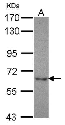 Western Blot: NT5C2 Antibody [NBP2-19597]