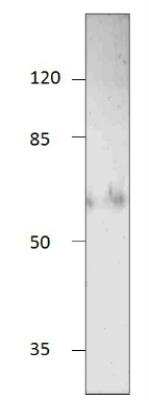 Western Blot: NT5C2 Antibody [NBP3-12213]