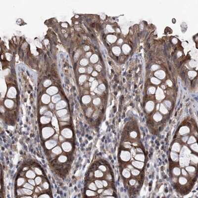 Immunohistochemistry-Paraffin: NT5C3 Antibody [NBP1-85525]