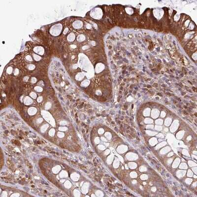 Immunohistochemistry-Paraffin: NT5C3 Antibody [NBP2-38124]