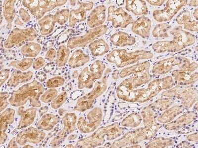 Immunohistochemistry-Paraffin: NT5C3 Antibody [NBP2-97728]