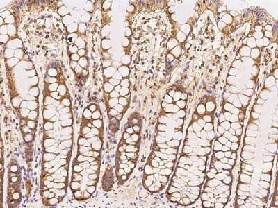 Immunohistochemistry-Paraffin: NT5C3 Antibody [NBP2-97728]