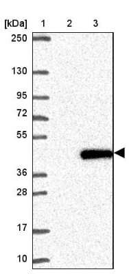 Western Blot: NT5C3 Antibody [NBP2-38124]