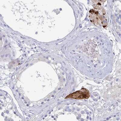 Immunohistochemistry: NT5C3L Antibody [NBP2-38818]