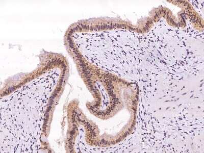 Immunohistochemistry-Paraffin: NT5C3L Antibody [NBP2-98136]