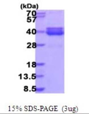 SDS-PAGE: Recombinant Human NT5C3L His Protein [NBP2-51896]