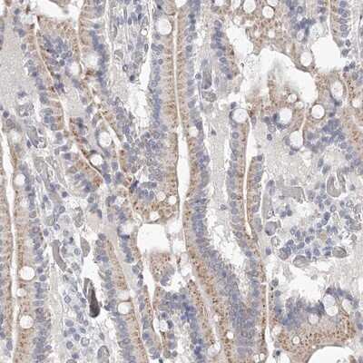 Immunohistochemistry-Paraffin: NT5DC1 Antibody [NBP1-85174]