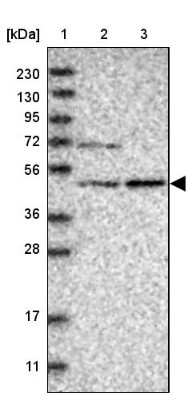 Western Blot: NT5DC1 Antibody [NBP1-85174]