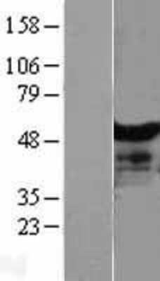 Western Blot: NT5DC1 Overexpression Lysate [NBL1-13825]