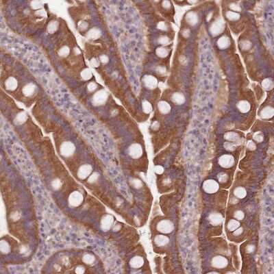 Immunohistochemistry-Paraffin: NT5DC2 Antibody [NBP2-13679]