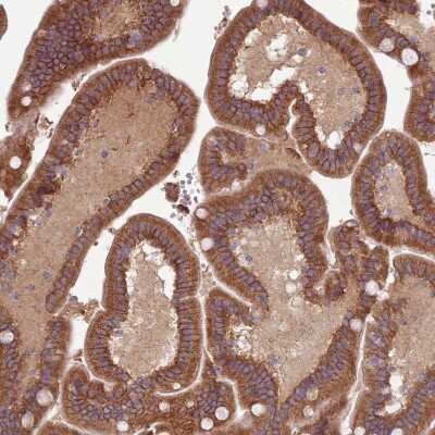 Immunohistochemistry-Paraffin: NT5DC2 Antibody [NBP2-13679]