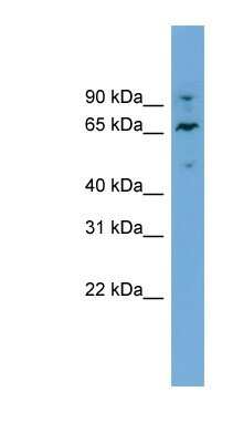 Western Blot: NT5DC2 Antibody [NBP1-70660]