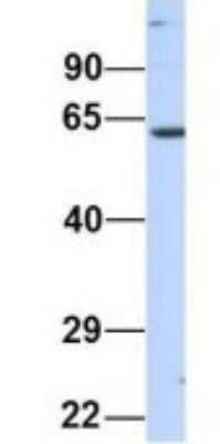 Western Blot: NT5DC2 Antibody [NBP1-70660]