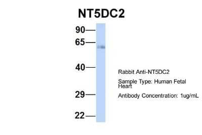 Western Blot: NT5DC2 Antibody [NBP1-70660]