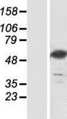 Western Blot: NT5DC3 Overexpression Lysate [NBP2-07014]