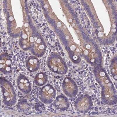 Immunohistochemistry-Paraffin: NT5M Antibody [NBP1-92203]