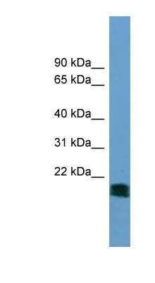 Western Blot: NT5M Antibody [NBP1-54683]