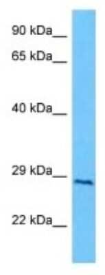 Western Blot: NT5M Antibody [NBP3-10056]