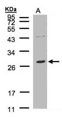 Western Blot: NTAL Antibody [NBP1-31177]