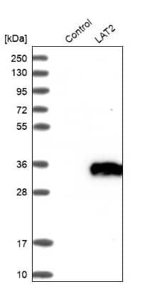 Western Blot: NTAL Antibody [NBP1-89661]