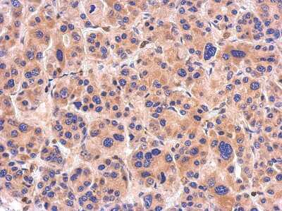 Immunohistochemistry-Paraffin: NTAN1 Antibody [NBP2-15046]