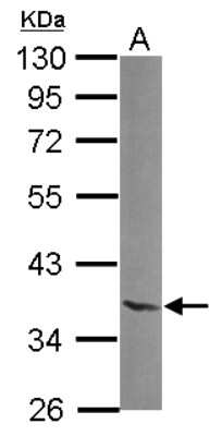 Western Blot: NTAN1 Antibody [NBP2-15046]