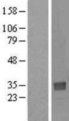 Western Blot: NTAN1 Overexpression Lysate [NBL1-13829]