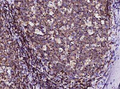 Immunohistochemistry-Paraffin: NTB-A/SLAMF6/CD352 Antibody (005) [NBP2-90027]
