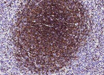 Immunohistochemistry-Paraffin: NTB-A/SLAMF6/CD352 Antibody (005) [NBP2-90027]