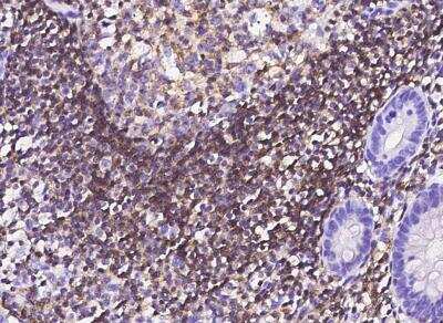 Immunohistochemistry-Paraffin: NTB-A/SLAMF6/CD352 Antibody (005) [NBP2-90027]