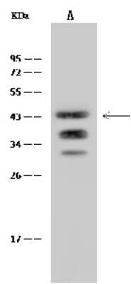 Western Blot: NTB-A/SLAMF6/CD352 Antibody (040) [NBP2-90508]