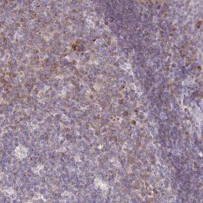 Immunohistochemistry-Paraffin: NTB-A/SLAMF6/CD352 Antibody [NBP2-49002]