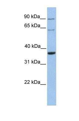 Western Blot: NTB-A/SLAMF6/CD352 Antibody [NBP1-69377]