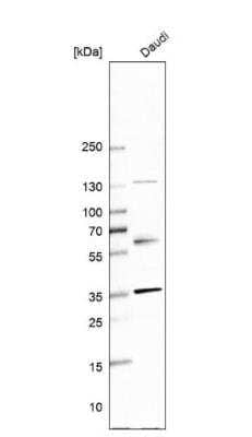 Western Blot: NTB-A/SLAMF6/CD352 Antibody [NBP2-49025]