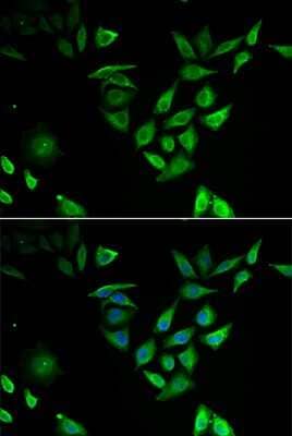 Immunocytochemistry/ Immunofluorescence: NTF2 Antibody - BSA Free [NBP3-03255]