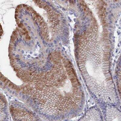 Immunohistochemistry: NTF2 Antibody [NBP1-82521]