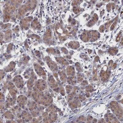 Immunohistochemistry-Paraffin: NTF2 Antibody [NBP1-82520]