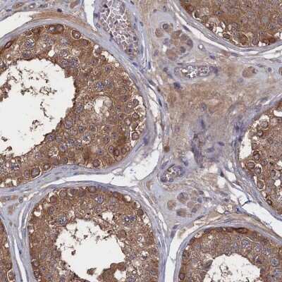 Immunohistochemistry-Paraffin: NTF2 Antibody [NBP1-82520]