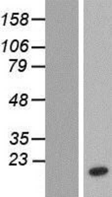 Western Blot: NTF2 Overexpression Lysate [NBP2-10444]