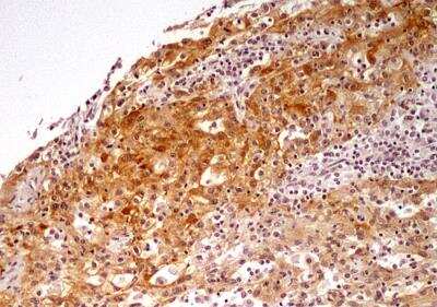 Immunohistochemistry-Paraffin: NTH1 Antibody - BSA Free [NB100-108]