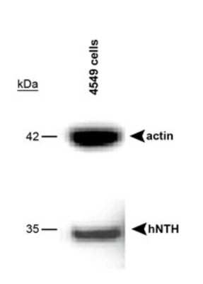 Western Blot: NTH1 Antibody [NB100-302]