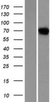 Western Blot: Netrin-4 Overexpression Lysate [NBP2-06541]