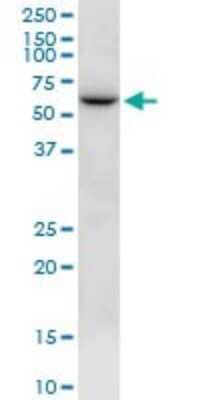 Western Blot: NTN5 Antibody [H00126147-B01P]