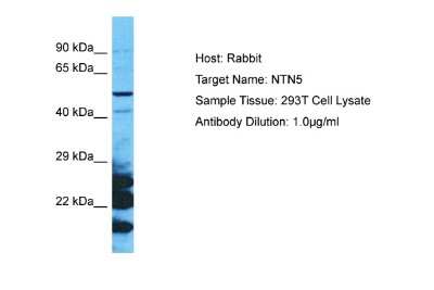 Western Blot: NTN5 Antibody [NBP2-84193]