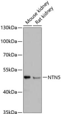 Western Blot: NTN5 AntibodyAzide and BSA Free [NBP2-93713]