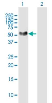 Western Blot: NTNG1 Antibody [H00022854-B02P]