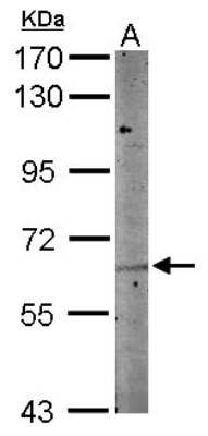 Western Blot: NTNG1 Antibody [NBP2-15047]