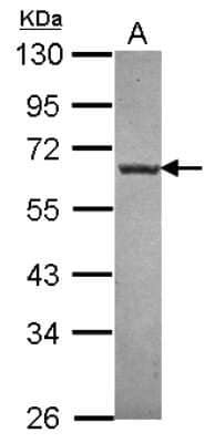 Western Blot: NTNG1 Antibody [NBP2-15047]