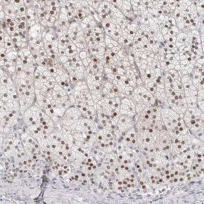 Immunohistochemistry-Paraffin: NTPCR Antibody [NBP1-88331]